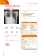 TUS | Dahiliye Sorularla Son Tekrar Kitabı - Görsel 4