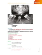 DUS | Ağız Diş ve Çene Radyolojisi – Konu Kitabı - Görsel 6